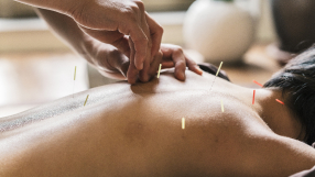 acupuncture room image