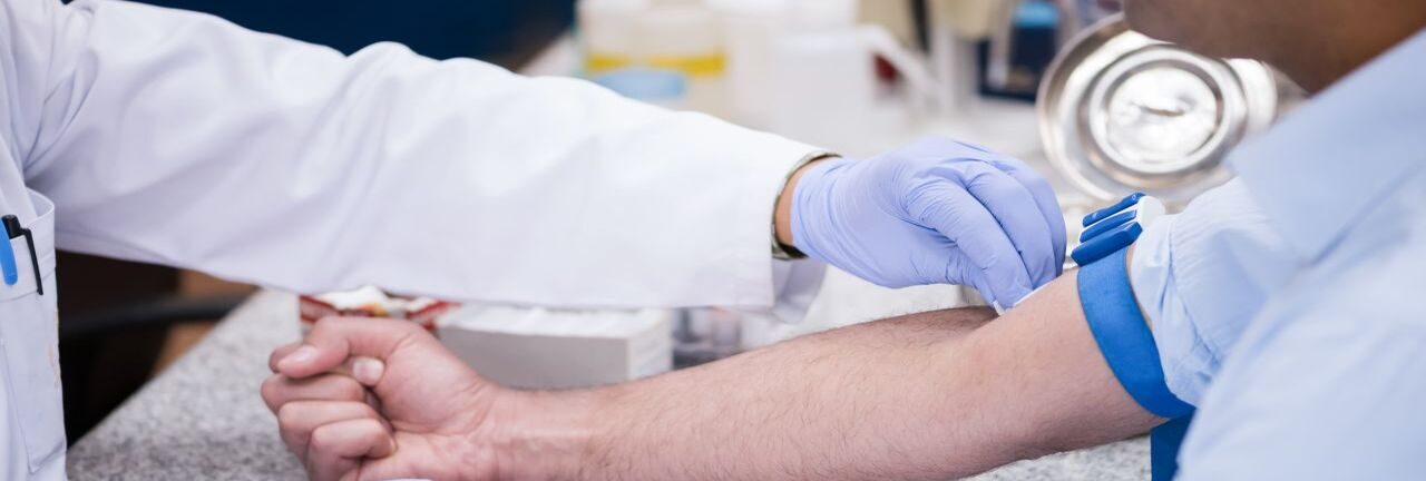 Free Hepatitis C Testing Comes to San Diego County, California